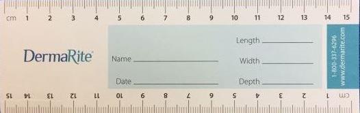 Wound Measuring Guide