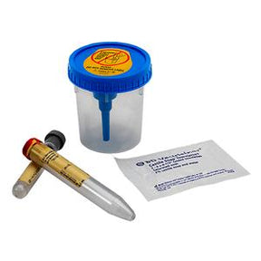 Sterile urine specimen container with blue lid, two blood collection tubes, and alcohol prep pad
