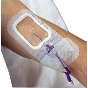 Sorbaview Shield Adhesive Dressing, 3.75" X 5.5"