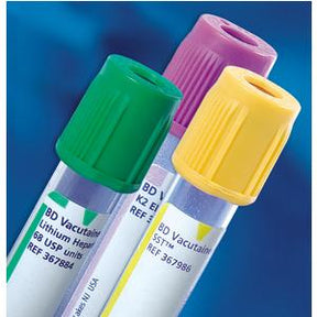 Three blood collection tubes with green, yellow, and purple caps on a blue background