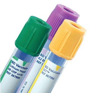 Three vacuum blood collection tubes with green, purple, and yellow caps for medical sample testing