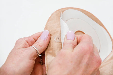 Hands removing adhesive backing from a beige ostomy bag for medical use