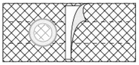 Medical adhesive pad with circular opening and peeled corner on grid background