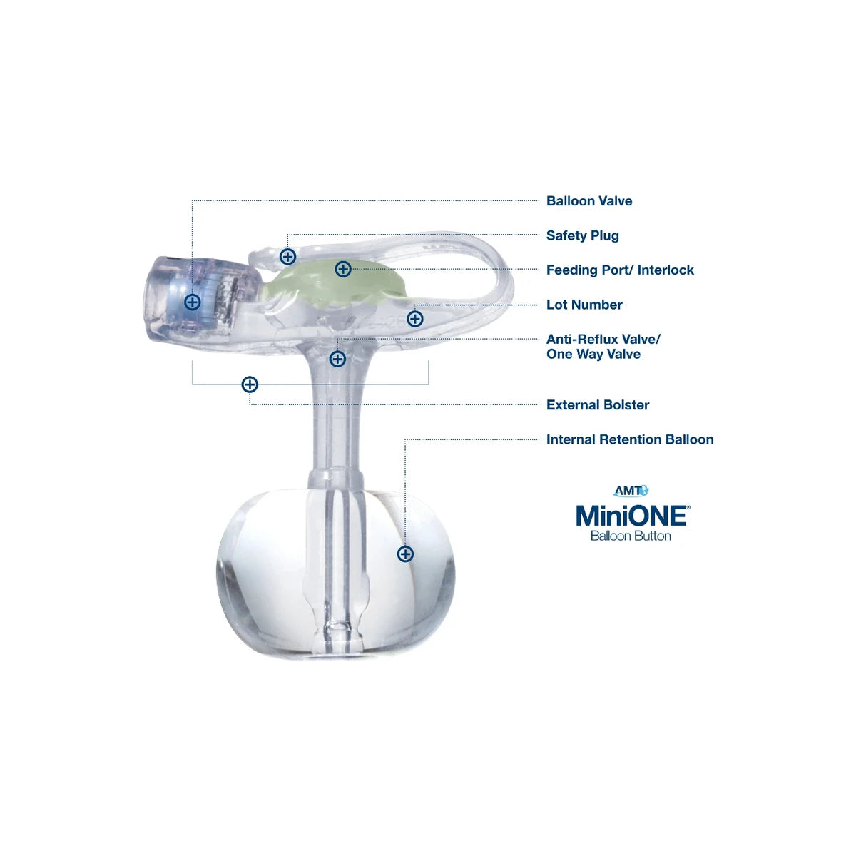 AMT MiniONE gastrostomy feeding tube with labeled parts, including balloon valve and safety plug.