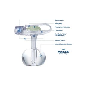 AMT MiniONE gastrostomy feeding tube with labeled parts, including balloon valve and safety plug.