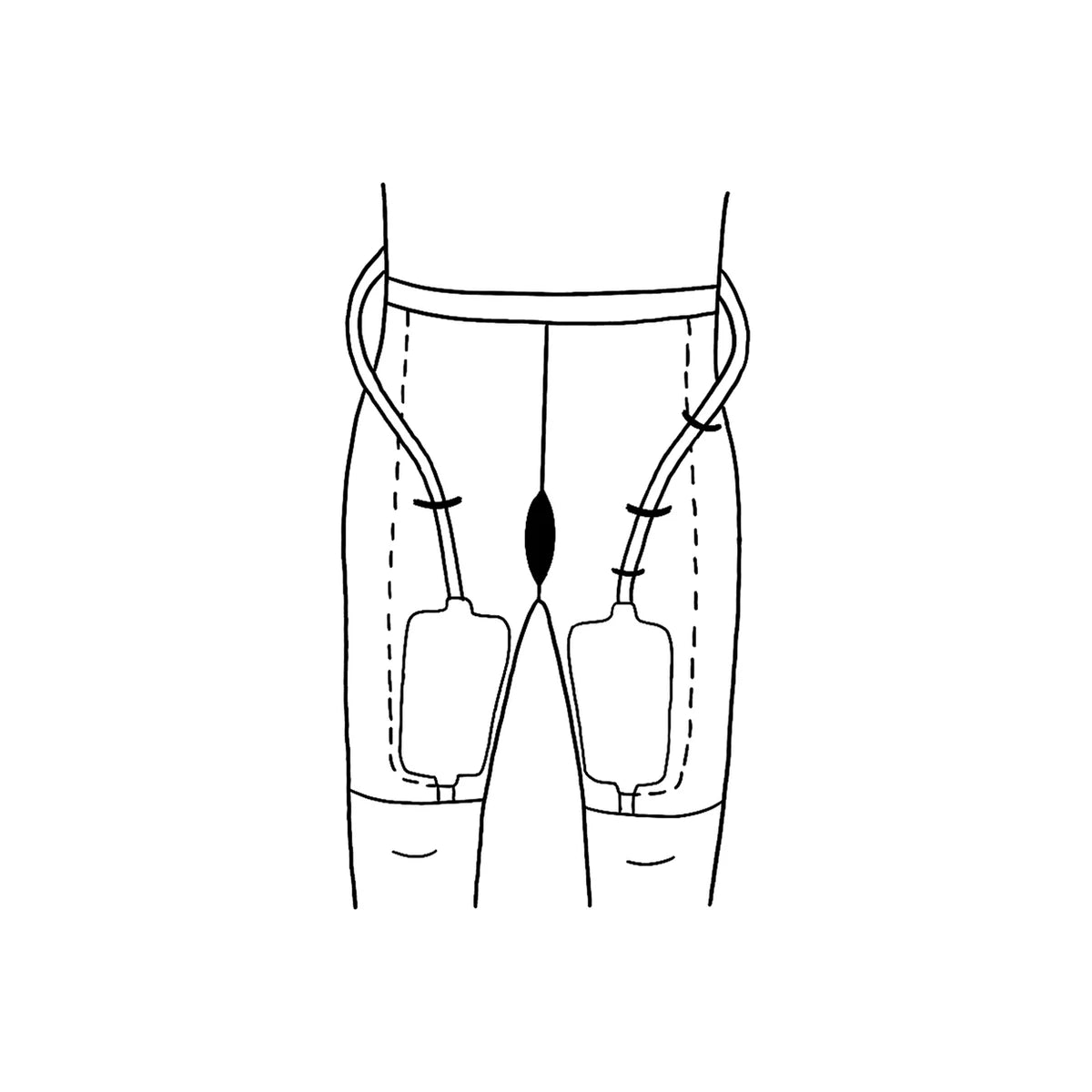 Diagram showing leg-mounted urinary drainage bags with connecting tubes for medical use