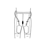 Diagram showing leg-mounted urinary drainage bags with connecting tubes for medical use