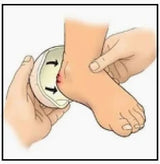 Applying ointment to a wounded heel for at-home medical care and wound relief