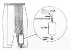 Diagram of a leg bag urinary drainage system attached to pants with tubing and release valve.