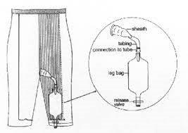 Diagram of a leg bag urinary drainage system attached to pants with tubing and release valve.